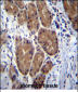 ZCRB1 Antibody (C-term)